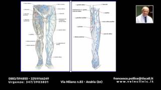 Diagnostica delle varici con eco color doppler [upl. by Lavena]