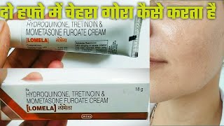 Lomela Cream Lomela Cream Ke fayde Aur Nuksan  Lomela Cream Review Lomela Cream application [upl. by Ruddy]