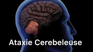 🔻 Comprendre LAtaxie cerebeleuse en 20 min seulement   Neurologie  4ème année medecine [upl. by Eiloj201]