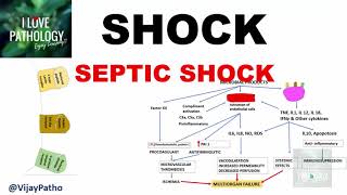 SHOCK Types Pathogenesis of Septic Shock [upl. by Atterbury]