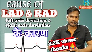 left axis deviation ecg  right axis deviation ecg in hindi  left axis deviation का कारण ecg ekg [upl. by Gaby]