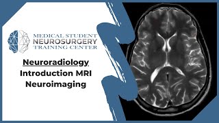 Neuroradiology Introduction MRI Neuroimaging [upl. by Jael]