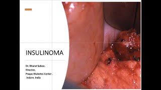 insulinoma [upl. by Anneyehc]