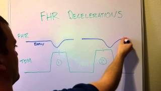 Fetal Heart Rate Decelerations Early Late Variable [upl. by Sredna292]