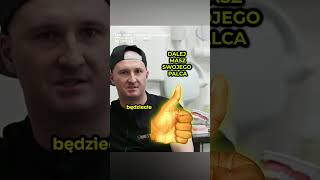 😱TNIEMY KCIUKA Implant Zęba Czy Leczenie Kanałowe 🤔 [upl. by Odnala]