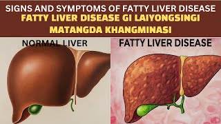 Fatty Liver Disease gi Laiyongsingi Matangda Khangminasi Manipuri [upl. by Ami]