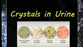 Urine Examination3 Crystals [upl. by Asor]