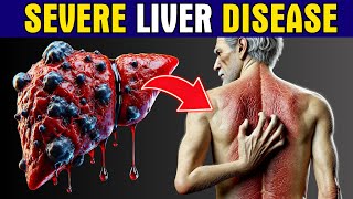 11 Strange Signs of LIVER DAMAGE Healthy Care [upl. by Womack]