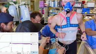 Cardiac Output measurement using thermodilution [upl. by Konstanze]