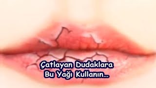 Çatlayan Dudaklara Bu Yağı Kullanın… [upl. by Anytsirk]