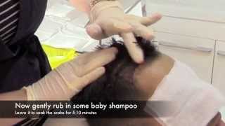 How to Wash Hair After a Hair Transplant  IK Clinics [upl. by Strage]