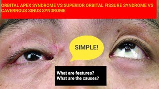 Orbital Apex vs Superior Orbital Fissure  Cavernous Sinus Syndrome [upl. by Yahsram]