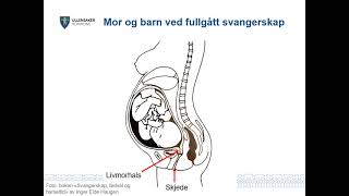 Fødselsforberedende kurs [upl. by Yentrac]