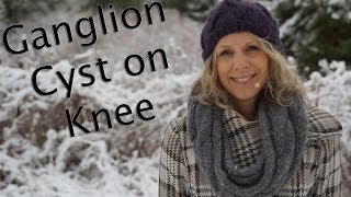 Ganglion Cyst on Knee Can Yoga Help [upl. by Gilligan]