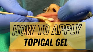 How to Apply Topical Gel on our Patient [upl. by Anneuq]