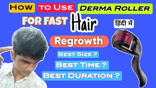 Derma RollerMicroneedling for Hair Regrowth डर्मा रोलर का उपयोग कैसे करें  dermaroller haircare [upl. by Colman639]