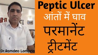 Duodenal Ulcer  पेट और आंतो के अल्सर  Peptic Ulcer Causes Symptoms amp Treatment  Gastric Ulcer [upl. by Tannie]