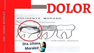 🥵Muelas del juicio cuánto dura el dolor pericoronaritis😲 [upl. by Anenahs]