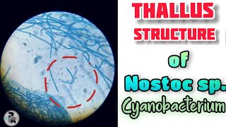 Nostoc sp thallus structure paperpenbiology [upl. by Elman679]