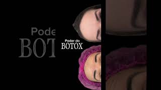 Botox na Testa Frontal com arqueamento de sobrancelha harmonizacaofacial botox toxinabotulinica [upl. by Leban]