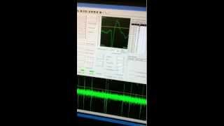 Electrophysiological Recording Example [upl. by Suicul561]