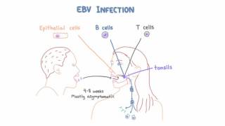 EBV and Mononucleosis  Pathogenesis and Clinical Presentation [upl. by Atilol]