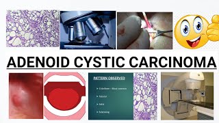 ADENOID CYSTIC CARCINOMA  COMPLETE DISCUSSION  IMAGES [upl. by Latoyia635]