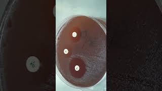 Antimicrobial Susceptibility Profile of Streptococcus agalactiae Comprehensive Testing Results [upl. by Yate600]