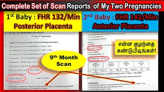 How to Find Baby Gender using Scan Reports in Tamil  Placenta  Fetal Heart Rate  Boy or Girl [upl. by Leorsiy]