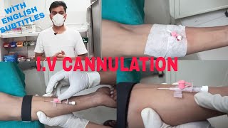 Intravenous Cannulation Technique  Iv Cannulation Procedure [upl. by Asaert]