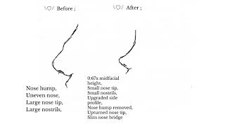 “ ᵛⁱʳᵗᵘᵃˡ ⁿᵒˢᵉ ˢᵘʳᵍᵉʳʸ “  Nose reconstruction subliminal ♡¸• Ultra Effective 🍥 [upl. by Clemens]