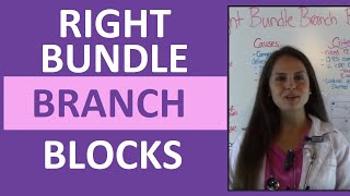 How to Interpret EKG Right Bundle Branch Blocks on ECG for Nurses [upl. by Guido]