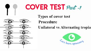 Cover test Part 1  Types of cover test  Cover  uncover Alternate cover [upl. by Rahas474]