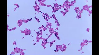 Acinetobacter species [upl. by Anahsirk]