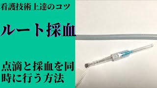 ルート採血が苦手なナース必見！！！実際に現場で役に立つ、ルート採血のやり方 ルートキープ ルート採血手順 駆血帯 [upl. by Cirdla]