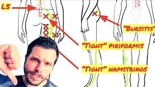 Trigger Point Release for Piriformis Muscle Not Working [upl. by Cis]