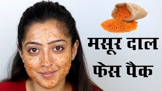 Masoor Dal Face Pack  मसूर दाल से फेस पैक बनाएं [upl. by Aneeles]