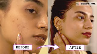 How To Improve Your Skin Texture  Skincare Tips For Bumpy Skin  Be Beautiful [upl. by Aicerg]