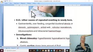 Paediatric Surgery in Arabic 4 Congenital Hypertrophic Pyloric Stenosis   by Dr Wahdan [upl. by Mortimer]