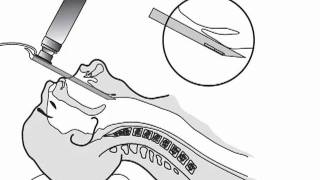 Laryngoscope Blade Use In ETI [upl. by Plotkin607]