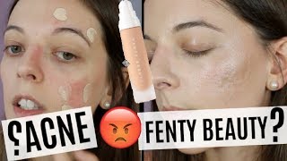 ACNE  Une Journée Avec FENTY BEAUTY ARNAQUE [upl. by Anilah452]