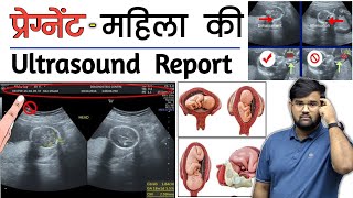 Pregnancy Ultrasound  Ultrasound Report  Medical  Doctor  MBBS  BHMS  BAMS  Nursing [upl. by Dnomso]