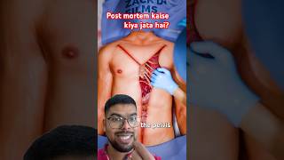 Post mortem kaise hota hai doctor science anatomy facts shorts postmortemreport [upl. by Hudson]