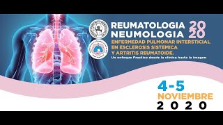 Webinar Enfermedad Pulmonar Intersticial en Esclerosis Sistemica y AR Nov 4 2020 [upl. by Ytoc]