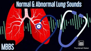 Normal amp Abnormal Lung sounds Wheeze Rhonchi Crepitus Stridor mbbs medicine neetpg [upl. by Sidnala]