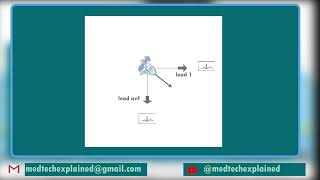 ECG FAST TRACK part 15 Normal lead and axis [upl. by Adnale]