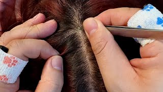 Gentle ASMR Scalp Care No Talking Soothing Dandruff Removal [upl. by Hersch]