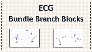 Bundle Branch Block  ECG  Right Bundle Branch Block  Left Bundle Branch Block  Explained [upl. by Auqinot]