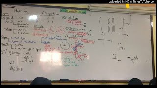 32 Dr Wael Salah astigmatism anisometropia [upl. by Legim66]