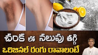 How to Get Rid of Dark Underarms  Remedy to Lighten your Armpits  Dr Manthenas Beauty Tips [upl. by Ahsilrac]